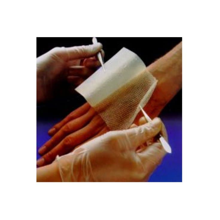 Jelonet Gasa para Heridas – 10 x 10 cm, 10 unidades