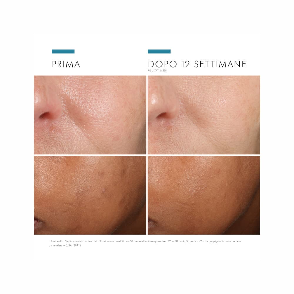 Phloretin CF Sérum – 30 ml